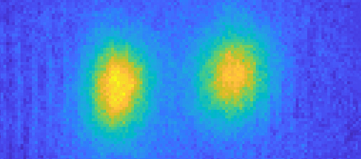  Avbildad ultraljudsintensitet från två samtidiga laserpulser absorberade i ett tunt skikt.