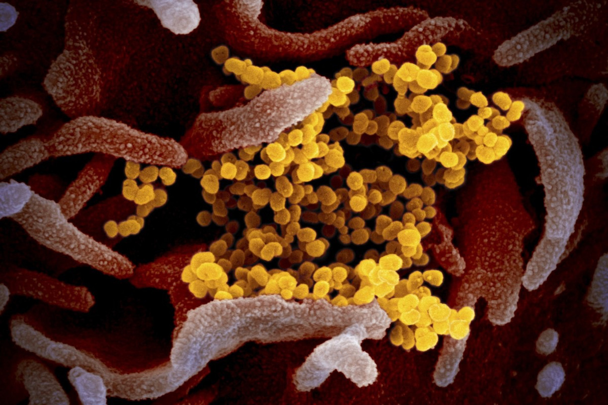 Microscope image of the virus
